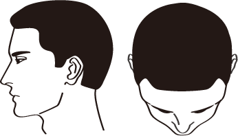 Ⅰ型